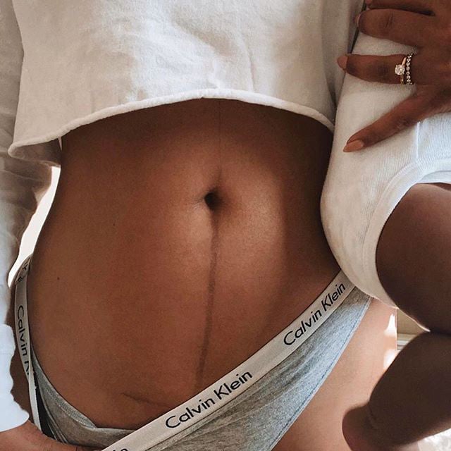 Read Now, Thank Us Later—Our Complete Postpartum Recovery Kit