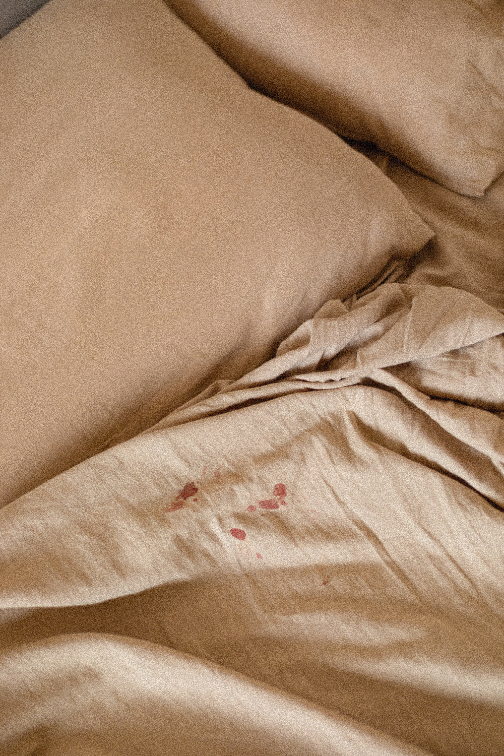 Implantation Bleeding Vs. Your Period: What You Need to Know