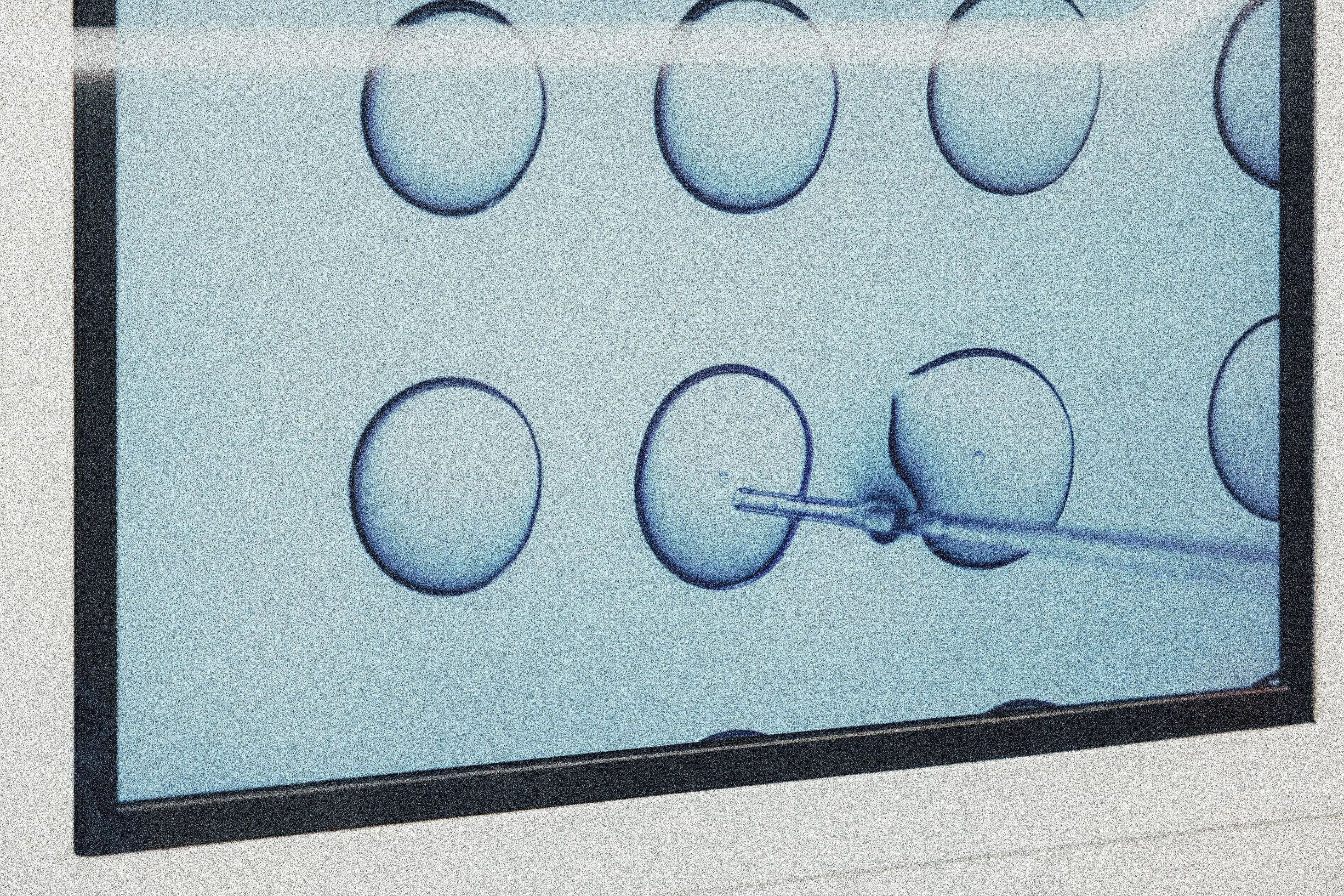 We're Sponsoring a Round of IVF with Baby Quest—Here's How to Apply