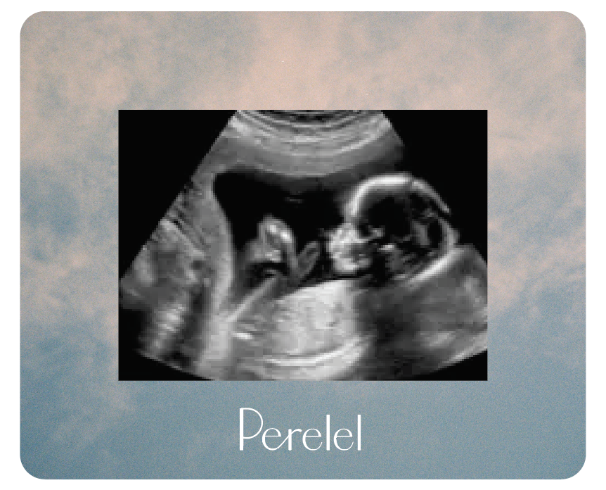 Sonogram Magnet Frame Gift